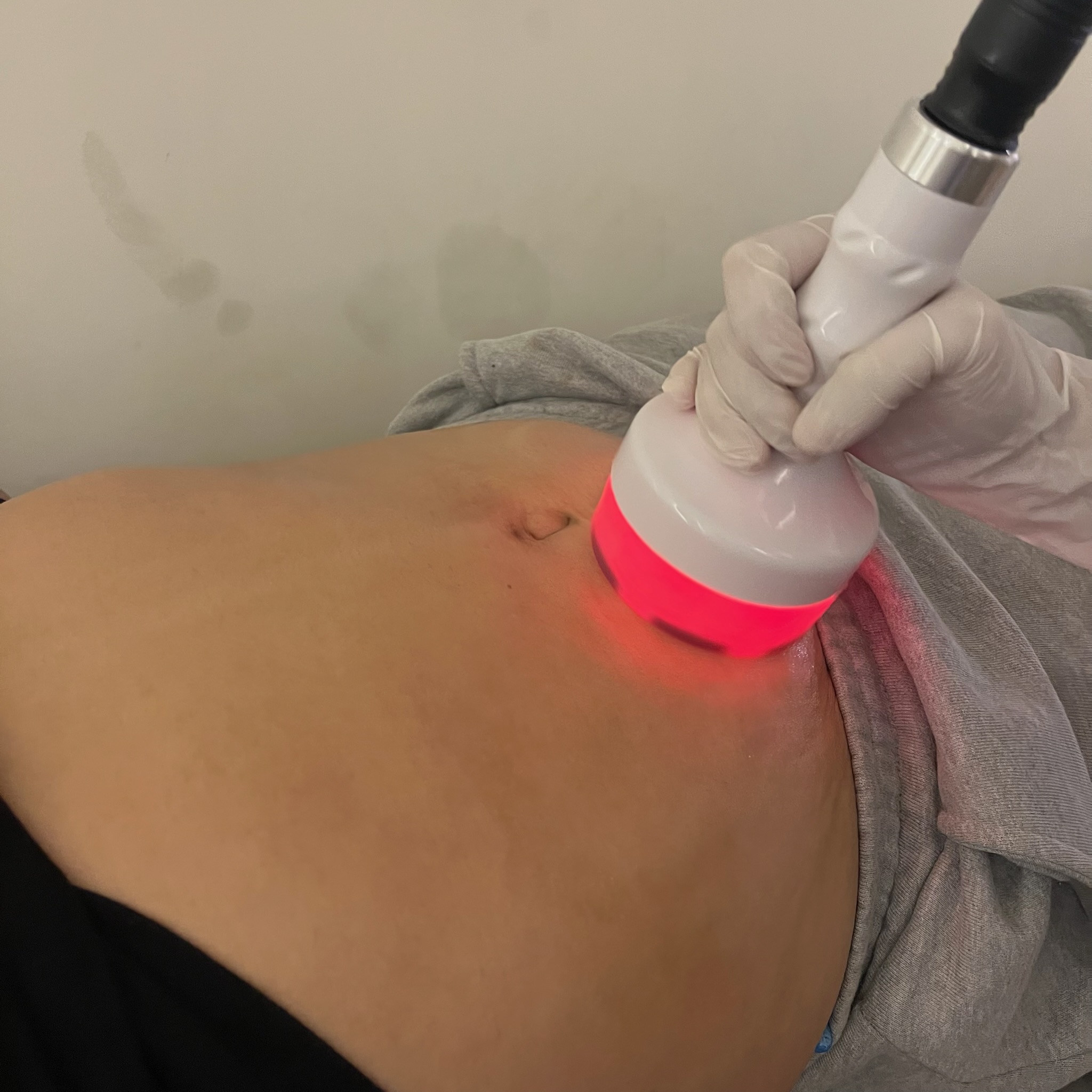 Ultrasound cavitation body treatment